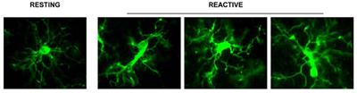 The Emerging Role of the Interplay Among Astrocytes, Microglia, and Neurons in the Hippocampus in Health and Disease